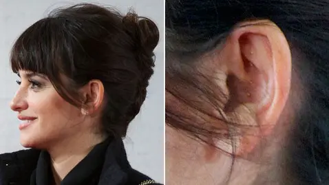 Penelope Cruz with Acupuncture Needles in Ear
