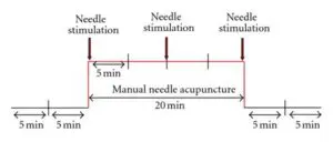 schematic for Litscher Study