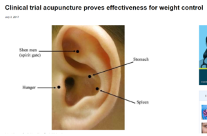 ear acupuncture points