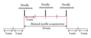 schematic for Litscher Study