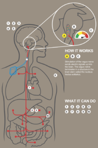 vagus nerve graphic